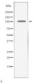 AMPD2 Antibody