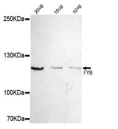 FYB Mouse mAb