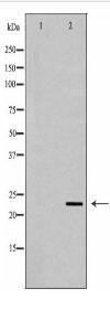 CD83 Antibody