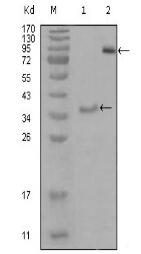 EphA3 antibody