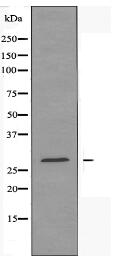 AQP1 Antibody