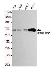 PRMT4/CARM1 Mouse mAb