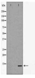 CALCA Antibody