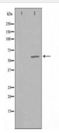 B4GALNT1 Antibody