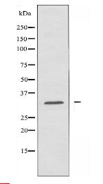 ABHD11 Antibody