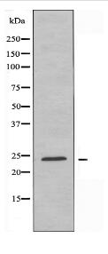 ARL2BP Antibody