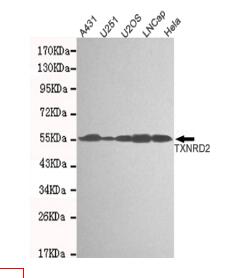 TXNRD2 Mouse mAb