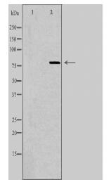 ARPP21 Antibody