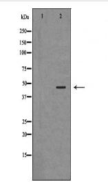 ANGPTL4 Antibody