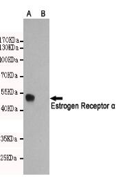 Estrogen Receptor α Mouse mAb