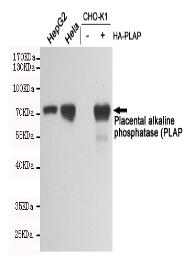 Placental alkaline phosphatase (PLAP) Mouse mAb