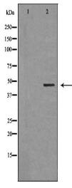 CDH23 Antibody