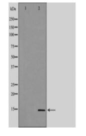 B2M Antibody