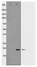 CD59 Antibody