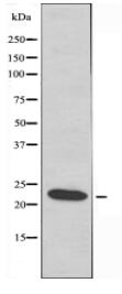 EFNA2 Antibody