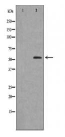 AVEN Antibody