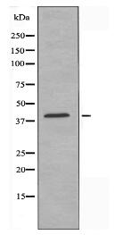 ACTBL2 Antibody