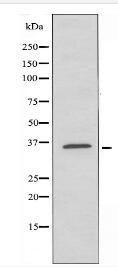 AKR1C2 Antibody