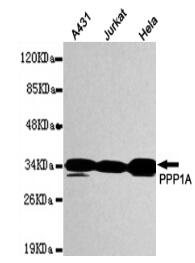 PPP1A Mouse mAb