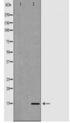 Histone H3R8me2s Antibody