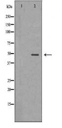 ACADM Antibody
