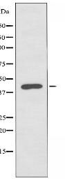 CKI-ε Antibody