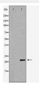BCL2 Antibody