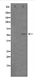 5-HT-3A Antibody