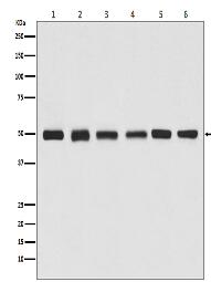 beta Tubulin Antibody (HRP conjugated)