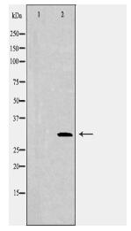 CDCA8 Antibody
