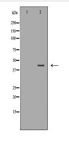 CSNK2A2 Antibody