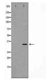 ATP1B1 Antibody