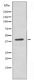 ADH7 Antibody