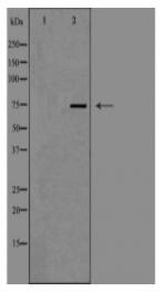 DCP1A Antibody