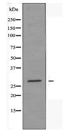 CLIC4 Antibody