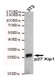 p27 KIP1 Mouse mAb