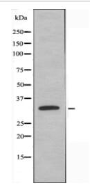 FOXE3 Antibody
