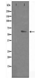 DOK7 Antibody
