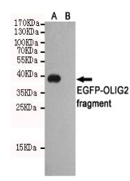 OLIG2 Mouse mAb