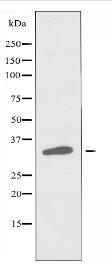 CKI-α Antibody
