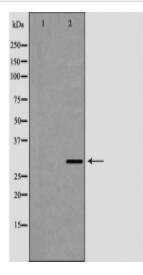 CA2 Antibody