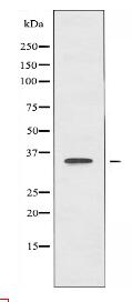 AASDHPPT Antibody