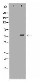 ALDH2 Antibody