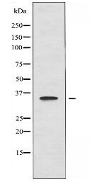CD1E Antibody