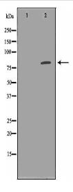 CEACAM5 Antibody