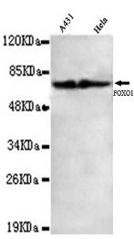 FOXO1(C-term) Mouse mAb