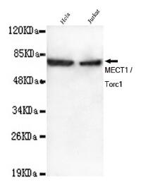 MECT1/Torc1 Mouse mAb