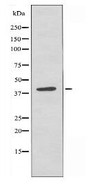 AGPAT3 Antibody