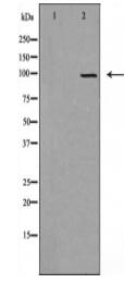 DMGDH Antibody