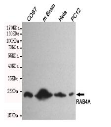 RAB4A Mouse mAb